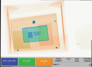 X-ray Screener